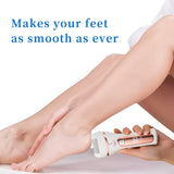 Electric Foot Callus Remover – USB Rechargeable Pedicure Grinder with 3 Grinding Heads & Strong Motor