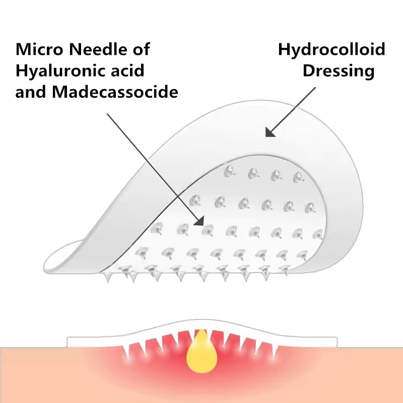 Waterproof Hydrocolloid Spot Patch with Tea Tree Oil — Invisible Acne Fix